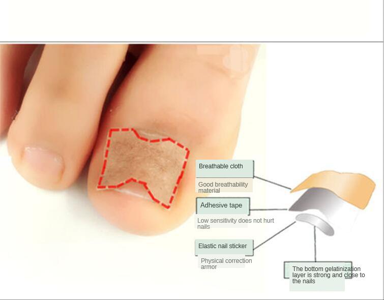 100 Pezzi Di Adesivi Per La Correzione Delle Unghie - Foto 5